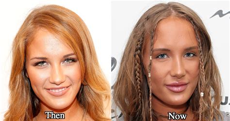 Niykee Heaton’s Plastic Surgery – What We Know So Far